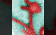 致死率約90%の「マールブルグ病」が赤道ギニアで拡散　専門家が指摘する「検査・陽性者隔離の徹底」で封印は可能
