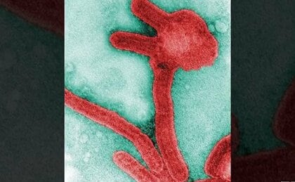 致死率約90%の「マールブルグ病」が赤道ギニアで拡散　専門家が指摘する「検査・陽性者隔離の徹底」で封印は可能