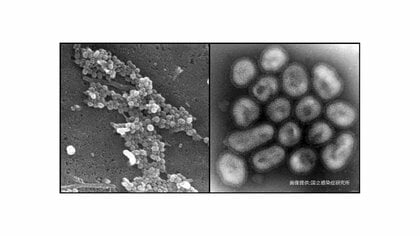 「インフルエンザは感染のピーク　新型コロナは増加」　感染リスクを避ける年末年始の過ごし方　インフルエンザ研究の第一人者が語るパンデミックへの備え