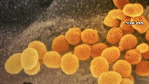 新型コロナ 新たに4853人の感染確認　全国の重症者 過去最多1050人
