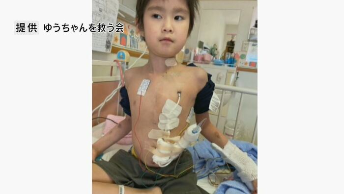 手術を繰り返してきた中沢維斗くん(提供:ゆうちゃんを救う会)