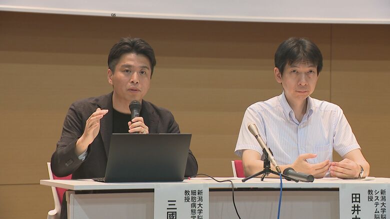 頭蓋骨を“透明”に！？新潟大学・理化学研究所が“シースルー法”開発「脳内に存在する細胞の観察可能に」｜FNNプライムオンライン