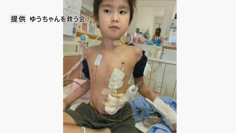 手術を繰り返してきた中沢維斗くん（提供：ゆうちゃんを救う会）