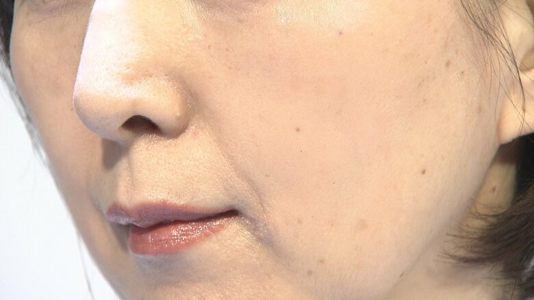 「Second Skin」技術によりほうれい線が補正されている