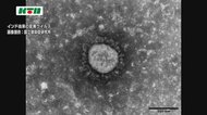 【速報】 新型コロナ 長崎県内で新たに1人の感染確認