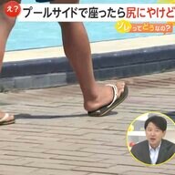 炎天下の水泳授業で小学生62人が尻にやけど！プールサイド長時間座ると気づかぬうちに「低温やけど」も…防止には履き物移動などの徹底を