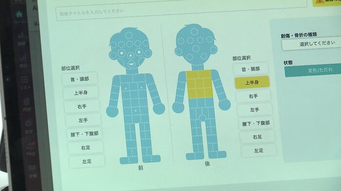 けがの状態などを詳細に記録できる(AiCAN)※開発中で表示内容は変更される可能性があります