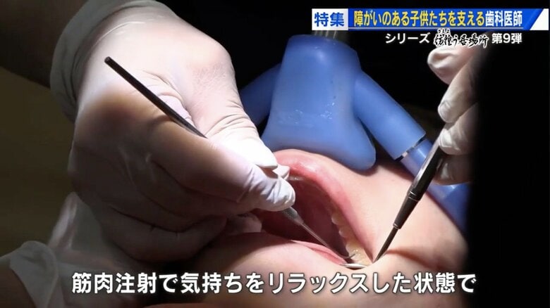 「歯の治療が怖くてパニックに…」 自閉症など障がいのある子どもに寄り添う歯科医師　“できる瞬間”を信じて【広島発】｜FNNプライムオンライン