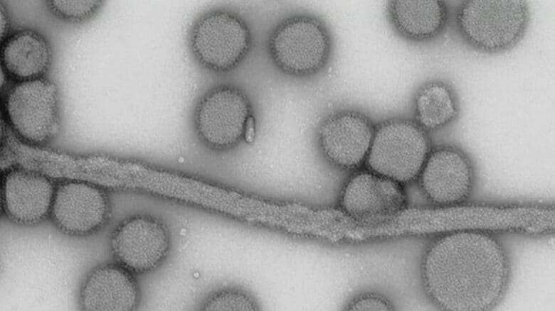 インフルエンザウイルス（提供：国立感染症研究所）