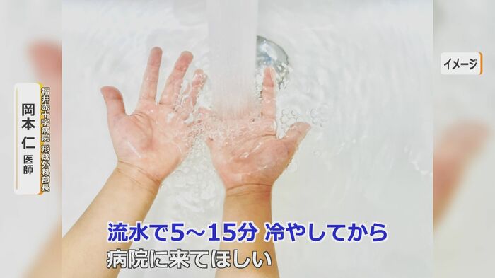 まずは流水で冷やすことが重要