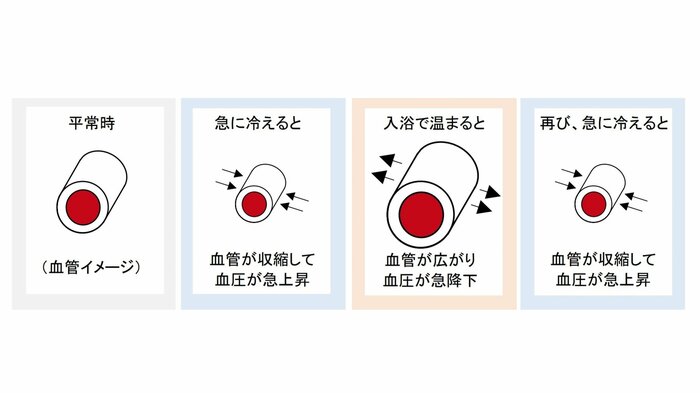 血管にはこんな変化が起きる(提供:須田さん)