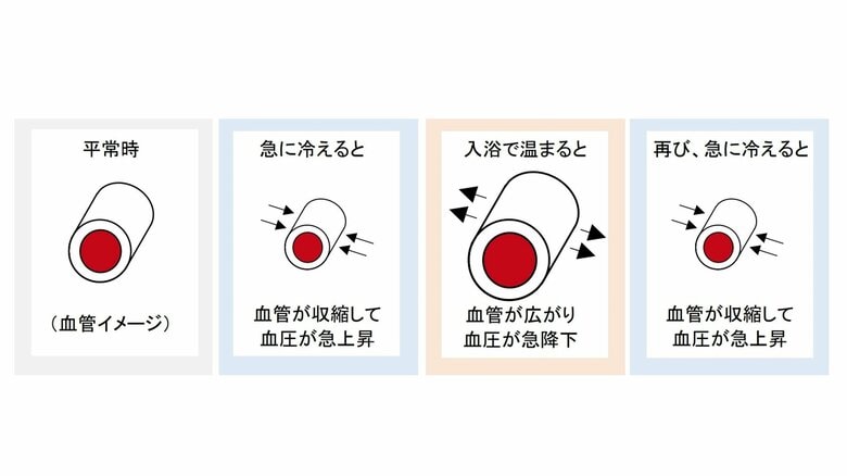 血管にはこんな変化が起きる（提供：須田さん）