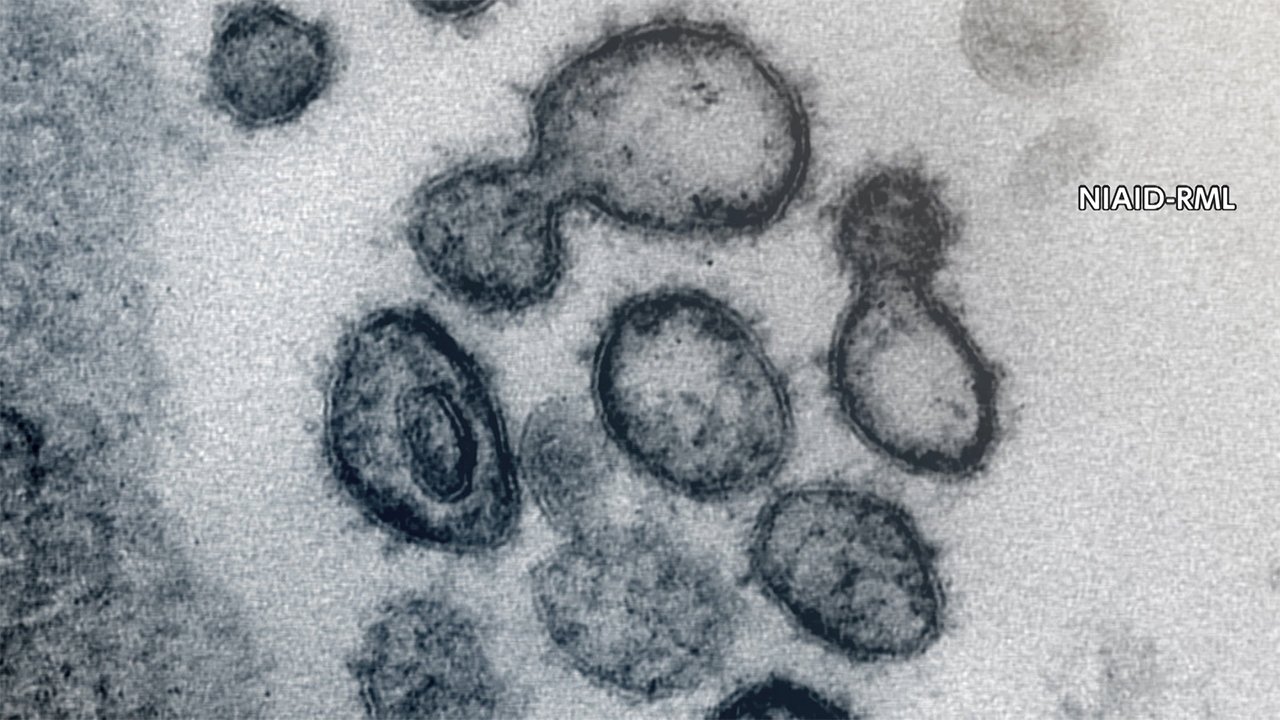 新規感染 3035人 東京は日連続前週下回る Fnnプライムオンライン Goo ニュース