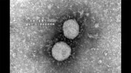 【速報】“インド型”感染で都内初の死者 5月下旬発症 がん患者50代男性