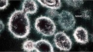 北海道 4人死亡 114人感染…変異ウイルスに感染25人 感染疑い155人
