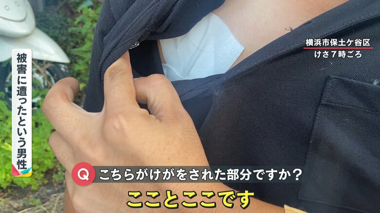 包丁でケガした箇所が痛々しい