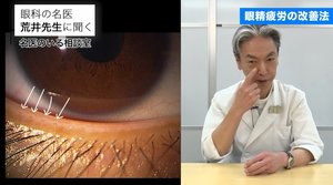 コロナ禍で増加する“眼精疲労”を解消…「マイボーム腺」のケアを眼科医が伝授