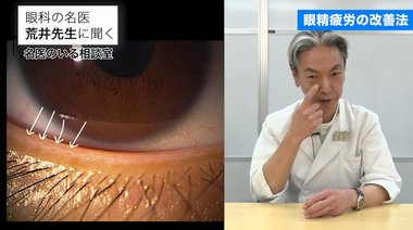コロナ禍で増加する“眼精疲労”を解消…「マイボーム腺」のケアを眼科医が伝授