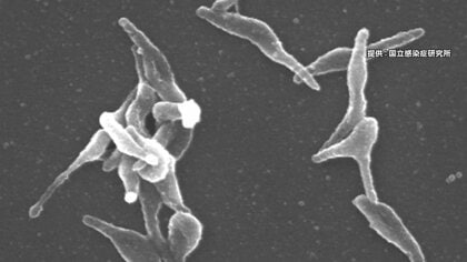 「マイコプラズマ肺炎」が過去最多に　秋・冬に増加？全国患者数が3週連続で増加　長引く咳や発熱が特徴
