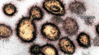 【速報】新型コロナ 全国の感染者6000人超　約3カ月半ぶり