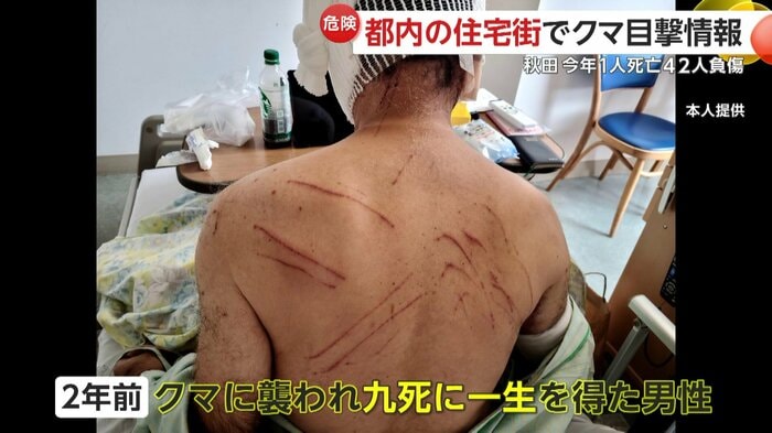 2年前にクマに襲われた湊屋啓二さん(68) :本人提供