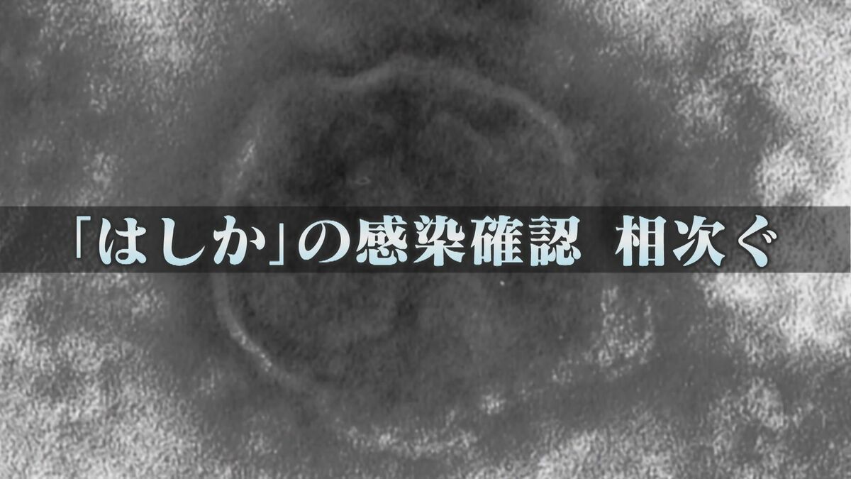 感染力はインフルの10倍 『はしか』感染相次ぐ 1日に4件感染確認も 9月は既に11件 病院で『抗体検査』が可能 【福岡発】