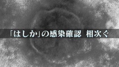 感染力はインフルの10倍 『はしか』感染相次ぐ 1日に4件感染確認も 9月は既に11件 病院で『抗体検査』が可能  【福岡発】
