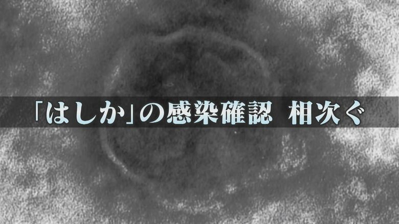 感染力はインフルの10倍 『はしか』感染相次ぐ 1日に4件感染確認も 9月は既に11件 病院で『抗体検査』が可能 【福岡発】|FNNプライムオンライン