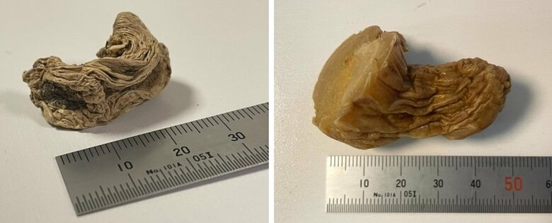 衝撃的なビフォーアフター