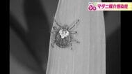 患者数が全国的に増加　マダニが媒介する感染症に注意　ズボンの裾は靴下に！対策と危険性を医師が解説