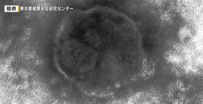 広島市で「麻しん（はしか）」感染を確認　感染力が強く高熱が続くと重症化の恐れも　｜FNNプライムオンライン