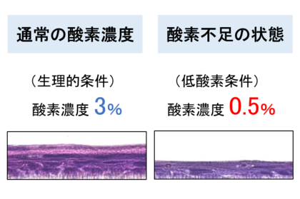 肌が薄くなるのは酸素不足? ~皮膚の低酸素状態が幹細胞に与える影響を解明~