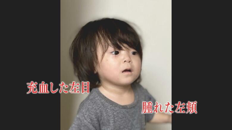 5月12日、星華ちゃんは母親と共に、虫歯の治療でかかりつけの歯科医院を訪れた