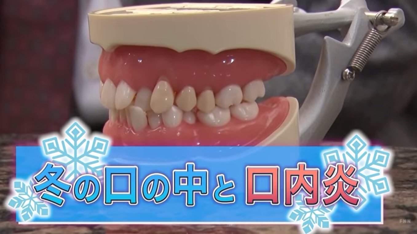 口内炎 症状 コロナ