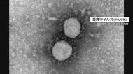 新型コロナウイルス 大分県内3人感染 病床使用率は約1か月ぶりステージ2の水準に