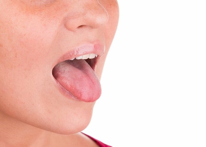 なめることは傷の治癒に影響しない、もしくは、傷の治りを早めてくれる(イメージ)