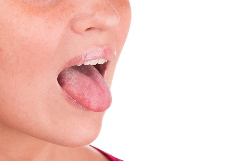なめることは傷の治癒に影響しない、もしくは、傷の治りを早めてくれる(イメージ)