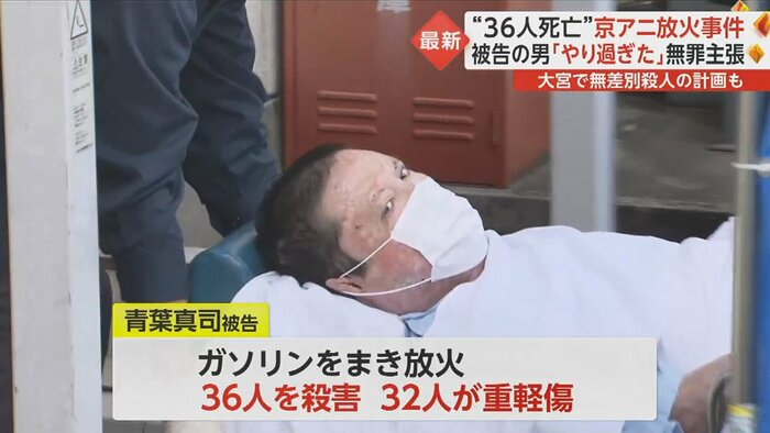 自身も全身の93%にやけどを負い、皮膚移植手術などの治療を受けた