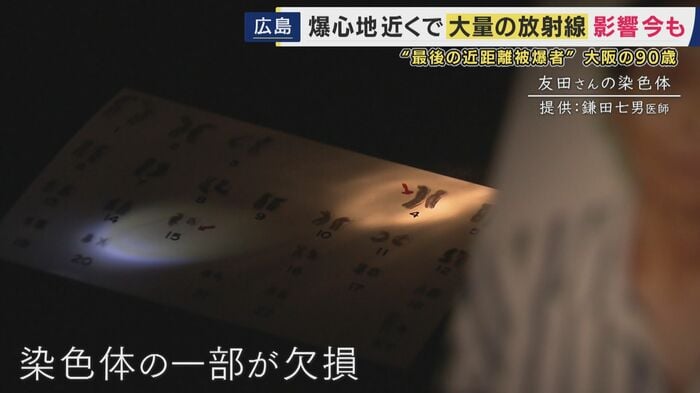 81年たった今も原爆に苦しめられる