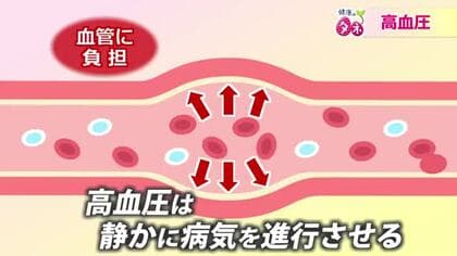 あるとき突然…脳卒中や心筋梗塞　静かに病気が進行するサイレントキラー「高血圧」　自分の血圧を知り塩分は控えめに