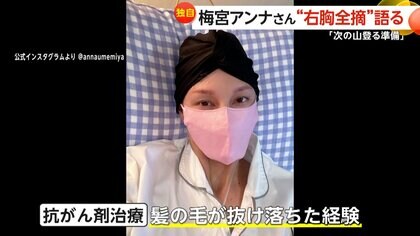 独自インタビュー】「まだまだ先は長い」梅宮アンナさん11月に右乳房全