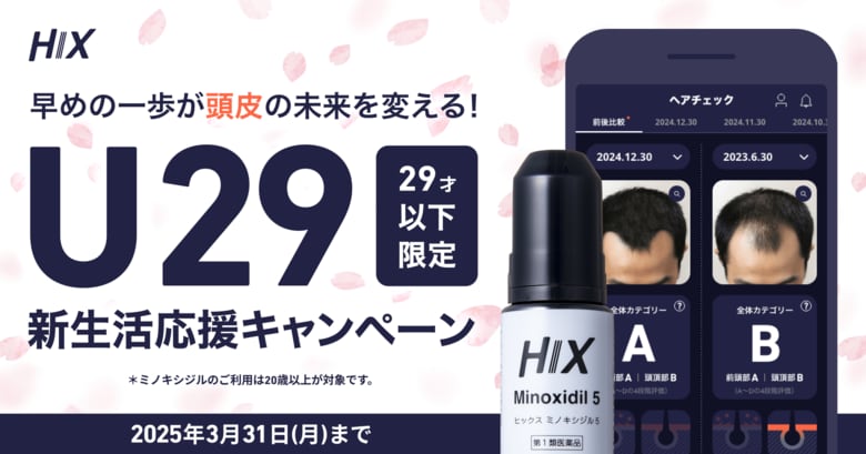 AGAの認知は高いが治療の壁も明らかに--HIX、「10・20代の薄毛に関する意識調査」を実施|U29新生活応援キャンペーン開催