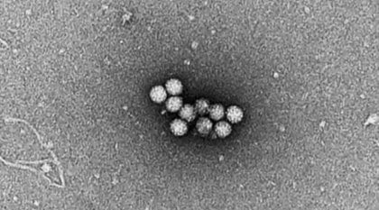 まだまだ“猛威”ノロウイルス　春になっても異例の“長期流行”の理由　2種類のウイルスが時期ずれて広がる　専門家「予防策の徹底を」【福岡発】