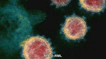 感染状況 岡山県で９人が感染 倉敷市でクラスター 岡山