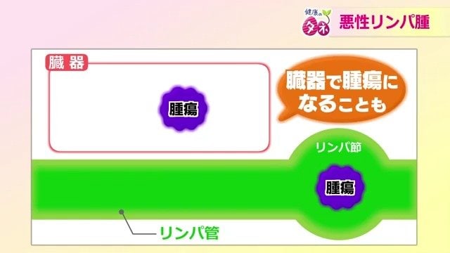 臓器でも発生する可能性がある