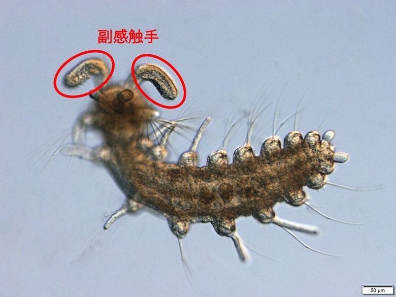 赤い丸で印をつけた部分が副感触手