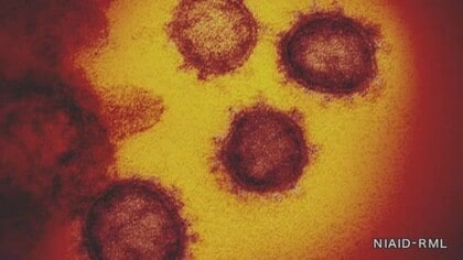 県 コロナ ウイルス 岩手 新型コロナウイルスのワクチン接種について