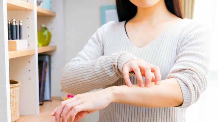 ダニなどを引き寄せることも(画像はイメージ)