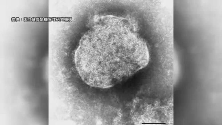高知県内4例目　はしかの患者確認｜FNNプライムオンライン