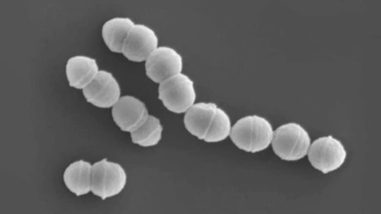 “人食いバクテリア”感染　福岡県内で新たに２人確認　今年計２８人に　去年上回るペース｜FNNプライムオンライン